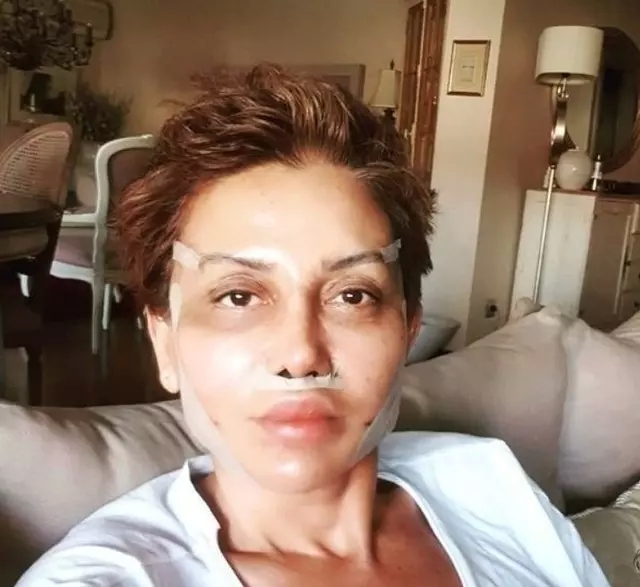 Serap Paköz'ün Eski Ve Yeni Hali Arasındaki Fark Şaşırttı