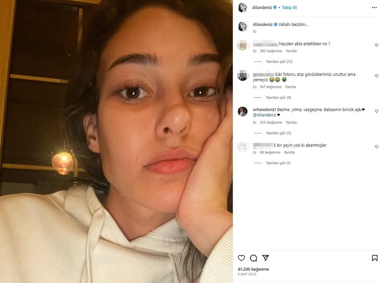 Dilan Çiçek Deniz'in Estetik Operasyonu Sonrası İşinden Oldu