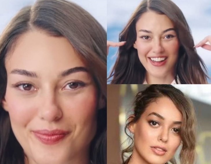 Dilan Çiçek Deniz'in Estetik Operasyonu Sonrası İşinden Oldu