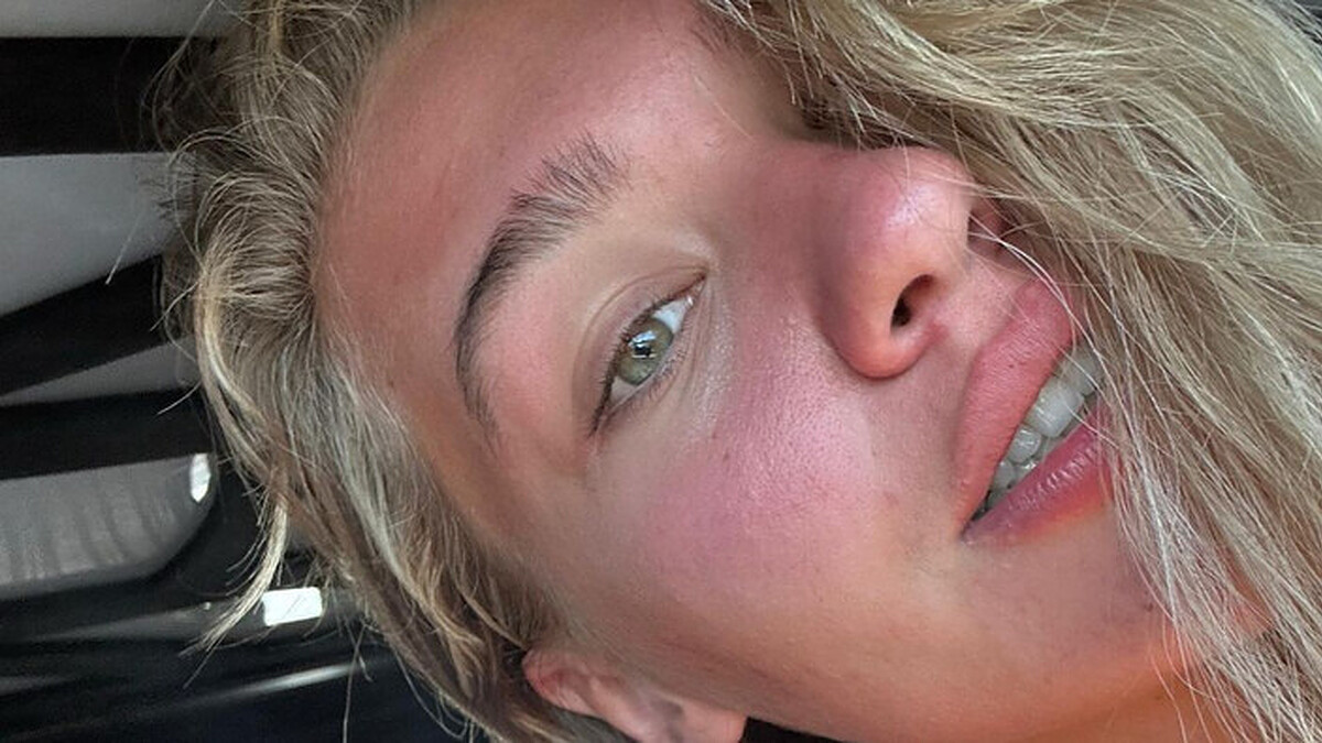 Melisa Döngel'den Makyajsız Paylaşım: Estetiğe Hayır