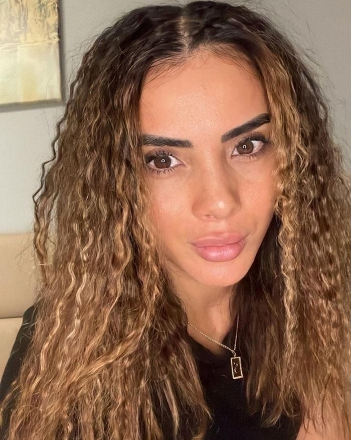Survivor'ın Sabriye Şengül'ü Estetik Operasyonla Tanınmaz Hale Geldi!