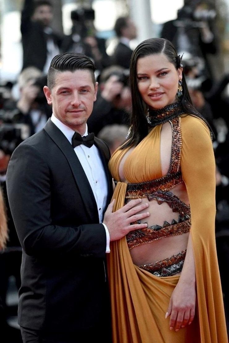 Adriana Lima, Estetik İddialarına Sessizliğini Bozdu!