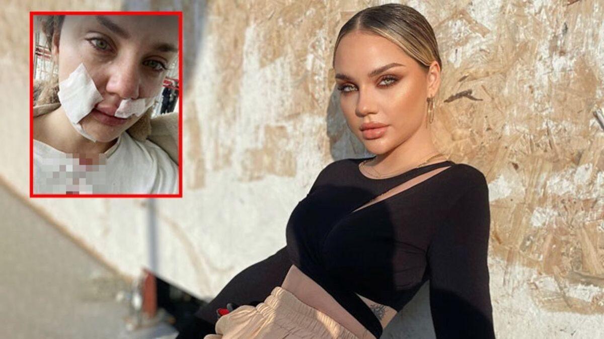 Fenomen Cansu Yeğin, Köpeği Tarafından Saldırıya Uğradı! Yüzünü Isırdı...