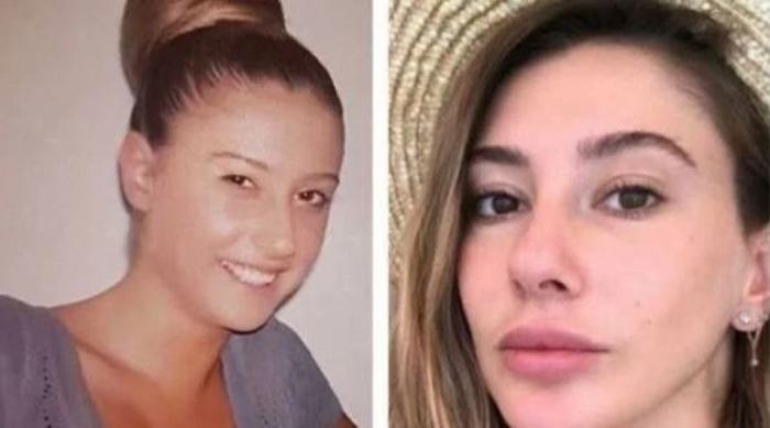 Şeyma Subaşı'nın Estetiksiz Halleri Olay Oldu!