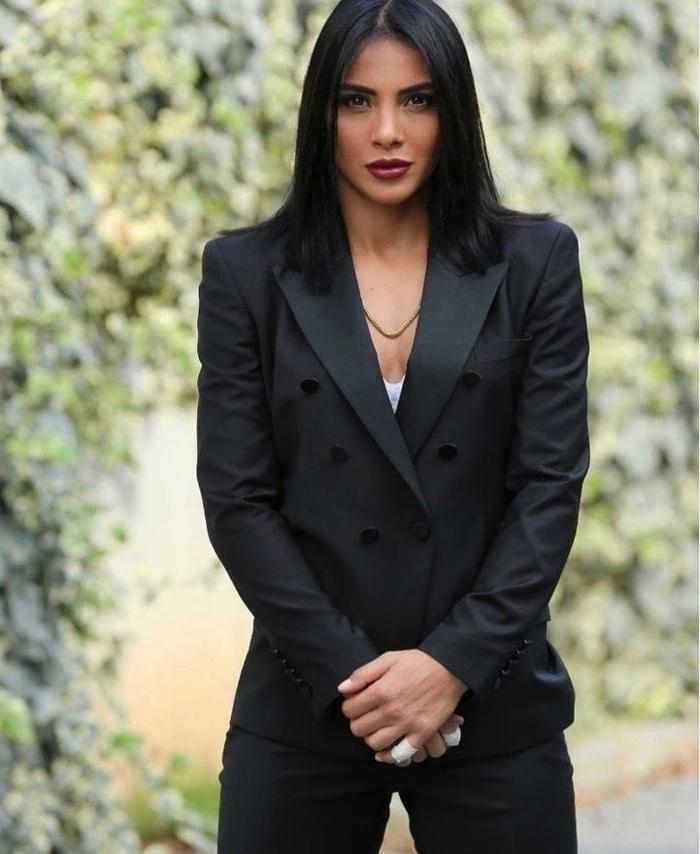 Survivor'ın Sabriye Şengül'ü Estetik Operasyonla Tanınmaz Hale Geldi!