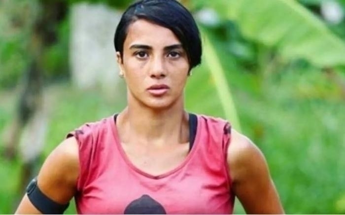 Survivor'ın Sabriye Şengül'ü Estetik Operasyonla Tanınmaz Hale Geldi!