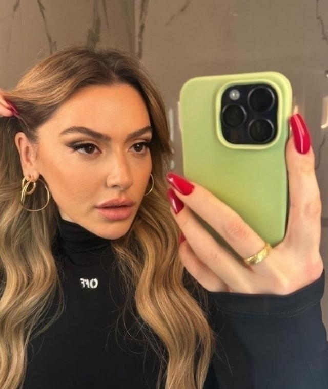 Hadise'nin Yüzündeki Değişim Dikkat Çekti! Estetik Mi Yaptırdı?