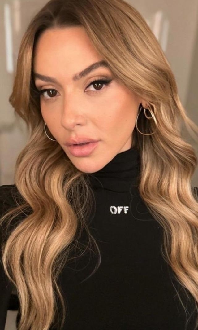Hadise'nin Yüzündeki Değişim Dikkat Çekti! Estetik Mi Yaptırdı?