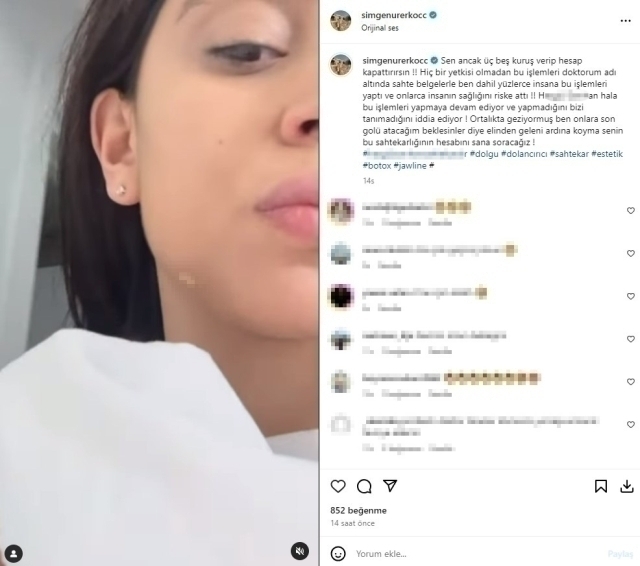 Kısmetse Olur Yarışmacısı Simge Nur Erkoç, Estetik Kurbanı Oldu!