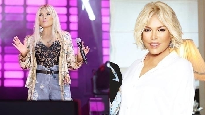 Ajda Pekkan, 77 Yaşında Estetik Oldu! Yüzünü Gerdirdi...
