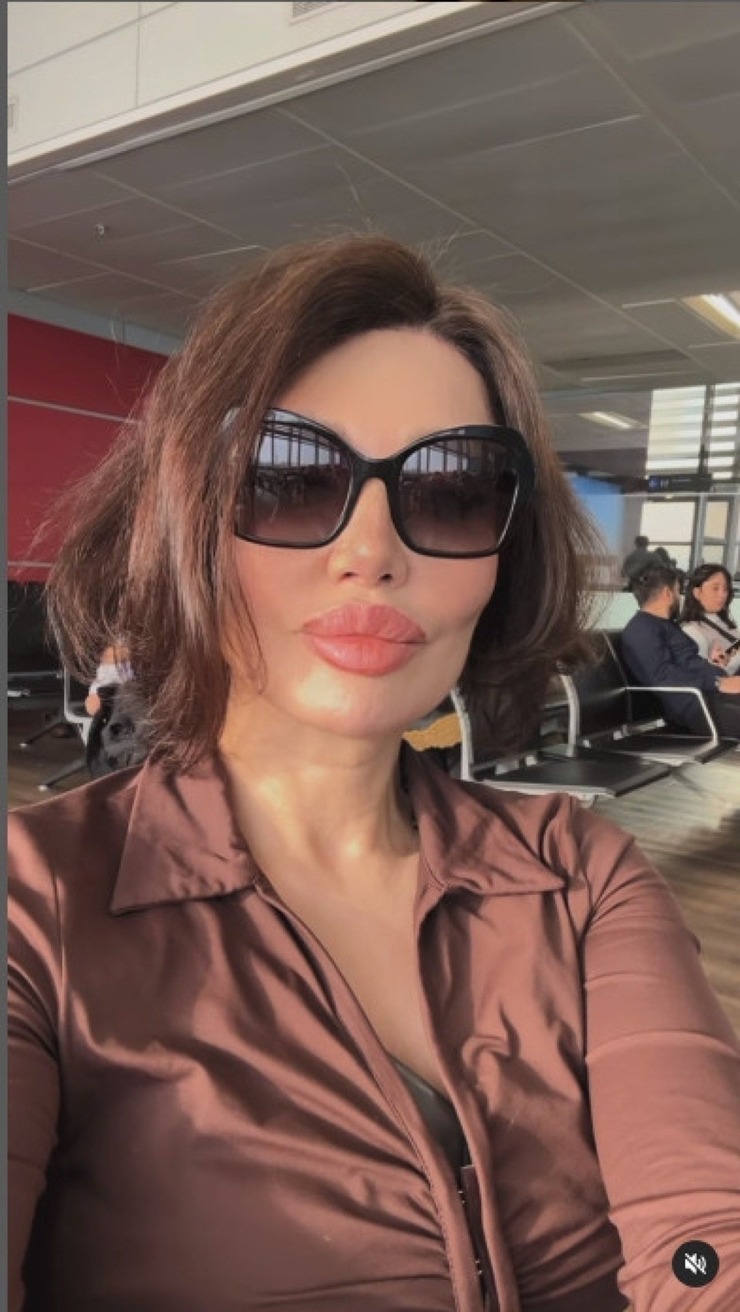 Umut Akyürek, Estetik Sonrası Belgin Dorak'a Benzetildi!