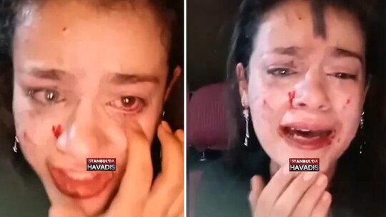 Sosyal medyada viral olan görüntüde Esen adlı genç kız lensini çıkaran Nilsu'ya...