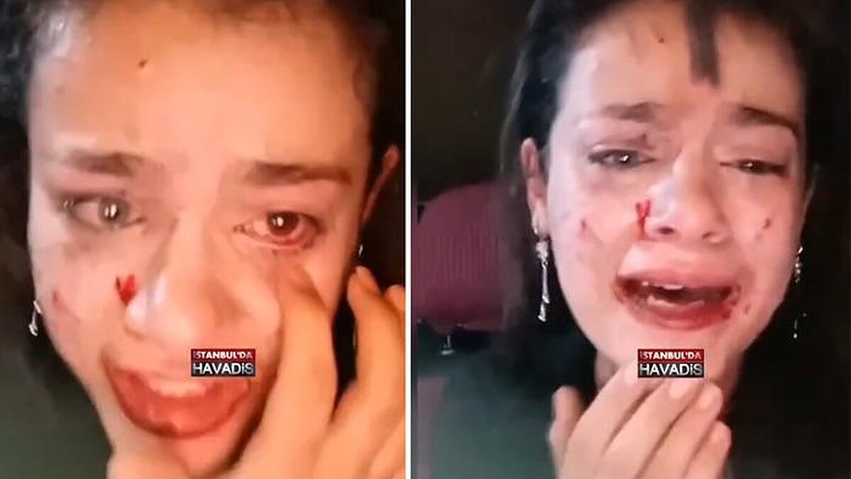 Yurt Odasında Genç Kızların Yaşadığı Kavga Sosyal Medyayı Salladı!