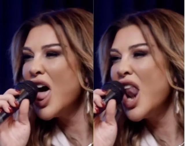 Selen Görgüzel'in 700 Bin Tl'lik Estetik Operasyonu Ve Şarkı Performansı Gündemde