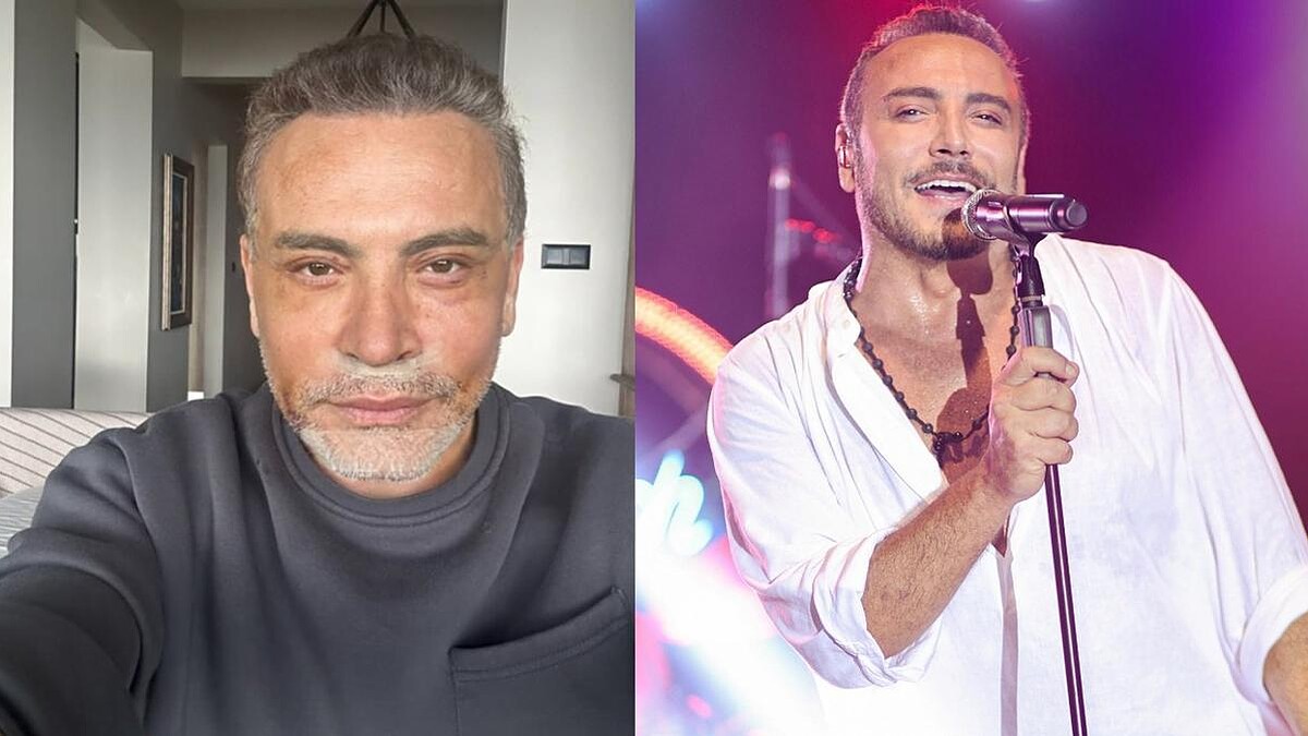 Cenk Eren'in Estetik Operasyonu Ve Ödediği Yüksek Ücret