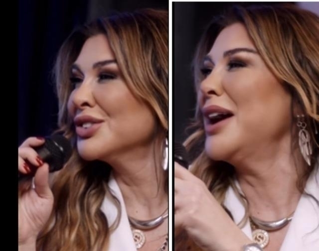 Selen Görgüzel'in 700 Bin Tl'lik Estetik Operasyonu Ve Şarkı Performansı Gündemde