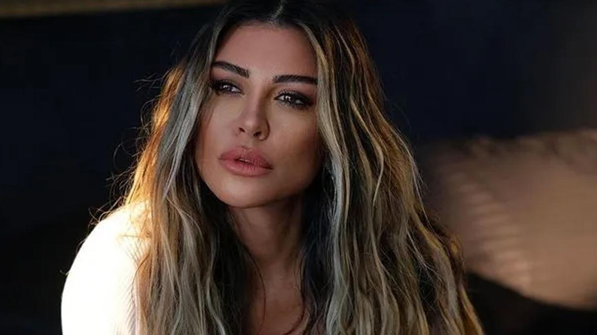 Selen Görgüzel Estetik Operasyon Sonrası Morarmış Yüzünü Paylaştı
