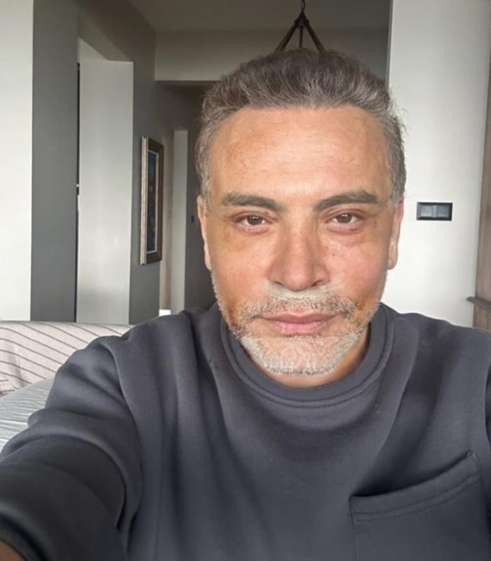 Cenk Eren'in Estetik Operasyonu Ve Ödediği Yüksek Ücret