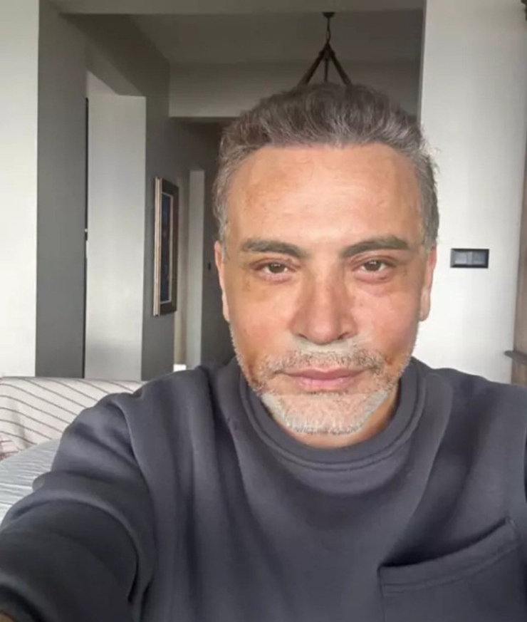 Şarkıcı Cenk Eren'den Üzücü Sağlık Haberi: Retina Yırtığı Ameliyat Edilecek