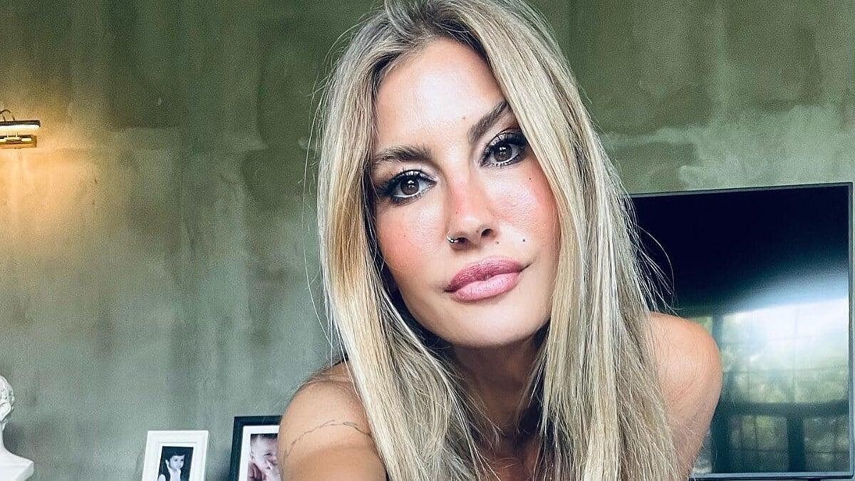 Çağla Şıkel Ve Nail Gönenli Ayrıldı! Şıkel'in Dudaklarındaki Değişim Şaşırttı