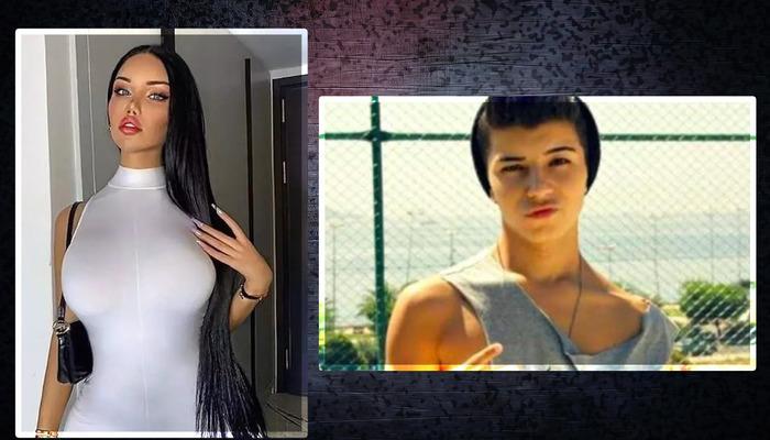 Beren Güney'in Cinsiyet Değişikliği Operasyonları Ve Zorlu Süreci