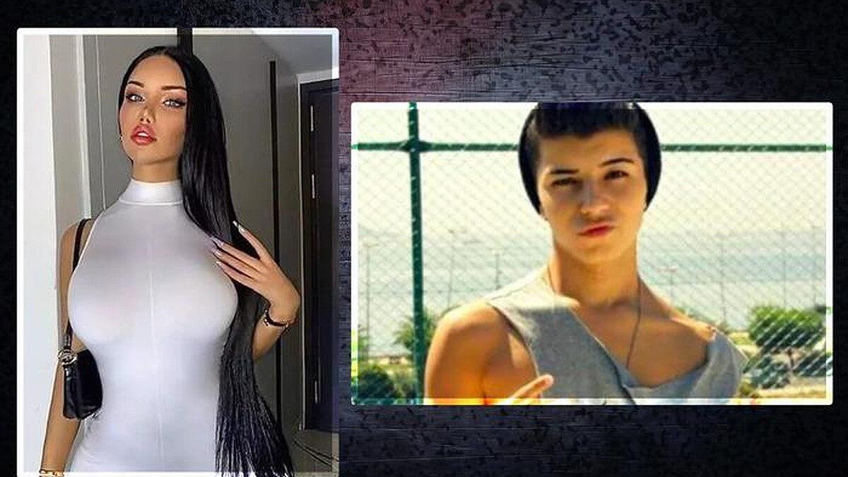 Beren Güney'in Cinsiyet Değişikliği Operasyonları Ve Zorlu Süreci