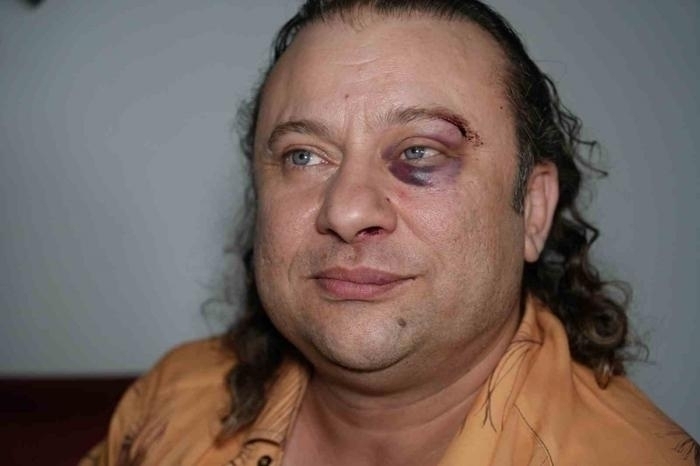 Onur Akay, Kadir Doğulu'ya Yumruklu Saldırı İddiasında Bulundu