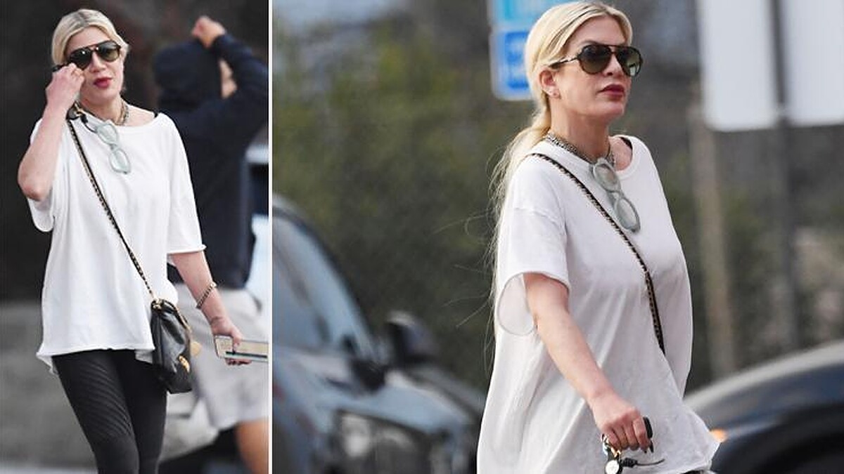 Tori Spelling: Eski Sevgilisiyle Asansörde Öpüşürken Ön Dişi Kırıldı