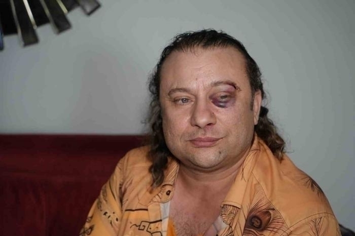 Onur Akay, Kadir Doğulu'ya Yumruklu Saldırı İddiasında Bulundu