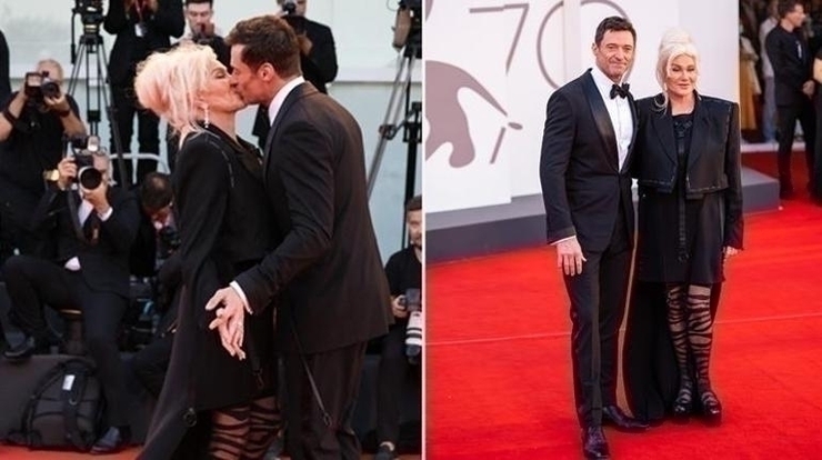 Hugh Jackman'ın Beklenmedik Ayrılığı Hayranlarını Şaşırttı