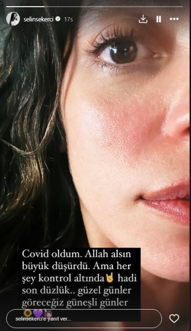 Selin Şekerci Covid-19'A Yakalandı: Hayranlarını Üzen Açıklama