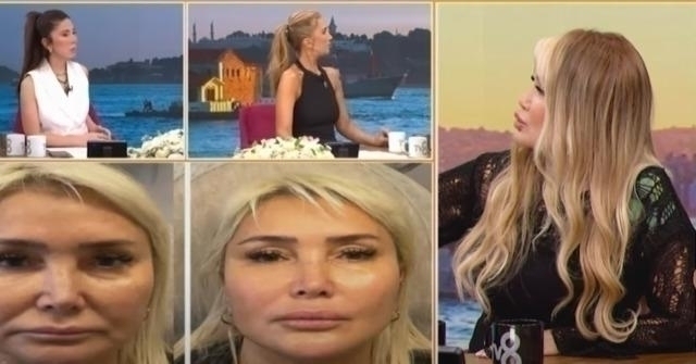 Yonca Evcimik Estetik Operasyonlarını Açıkladı: Müge Dağıstanlı'nın Sözleri Olay Yarattı