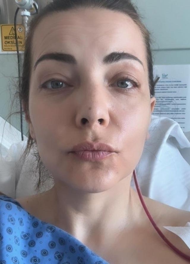 Ünlü Oyuncu Burcu Kara Beyin Ameliyatı Geçirdi!
