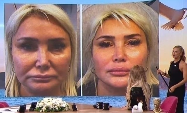 Yonca Evcimik Estetik Operasyonlarını Açıkladı: Müge Dağıstanlı'nın Sözleri Olay Yarattı