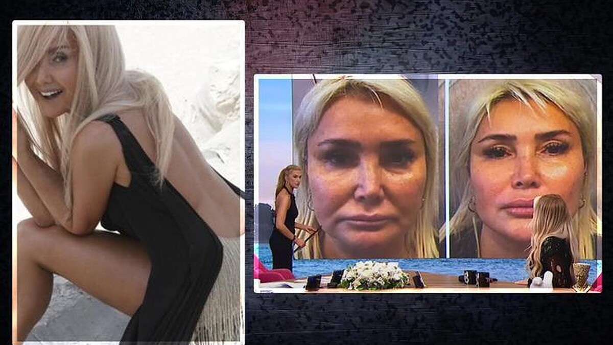 Yonca Evcimik Estetik Operasyonlarını Açıkladı: Müge Dağıstanlı'nın Sözleri Olay Yarattı