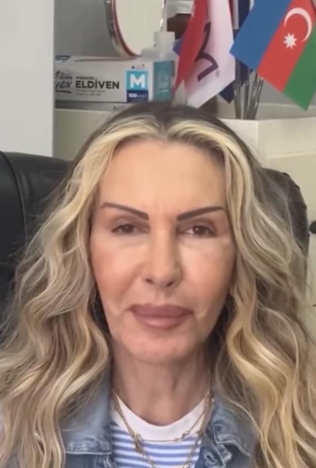 Petek Dinçöz, annesi Esra Süay Toğuş'un estetik sürecine destek oldu, mutlu sonuçlar aldı