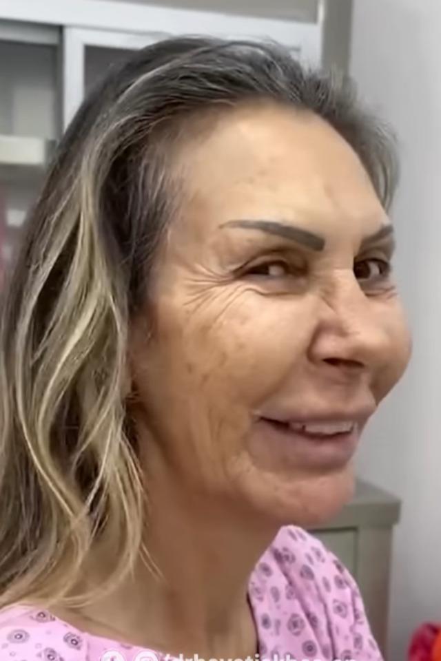 Petek Dinçöz, annesi Esra Süay Toğuş'un estetik sürecine destek oldu, mutlu sonuçlar aldı