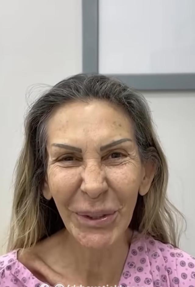 Petek Dinçöz, annesi Esra Süay Toğuş'un estetik sürecine destek oldu, mutlu sonuçlar aldı