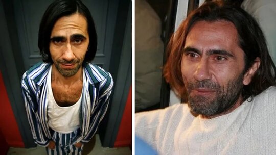 Peker Açıkalın beyin kanaması geçirdi, konuşma yetisini kaybetti ve ameliyat sürecine girdi