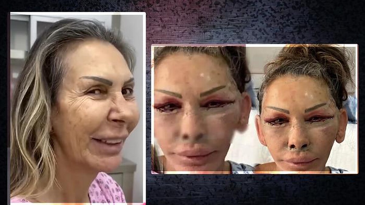 Petek Dinçöz, annesi Esra Süay Toğuş'un estetik sürecine destek oldu, mutlu sonuçlar aldı