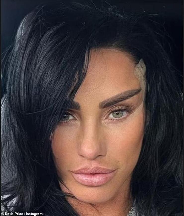 Estetik Bağımlılığıyla Gündeme Gelen Katie Price’a Ölüm Riski Uyarısı Geldi