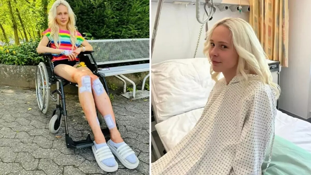 Sevgilisinin İsteği Üzerine 167 Bin Dolar Harcayıp Boyunu 1.70 Metreye Çıkardı