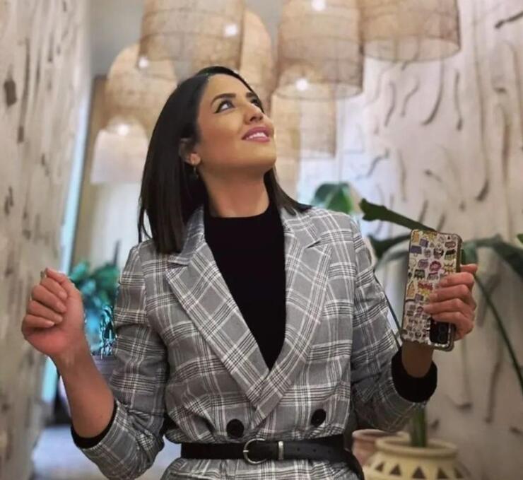 Azize Polat'ın MasterChef sonrası büyük değişimi! Estetikle bambaşka birine dönüştü