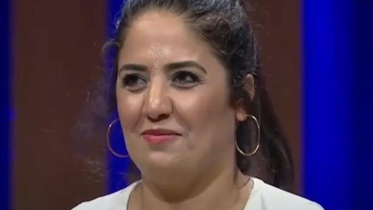 Azize Polat'ın MasterChef sonrası büyük değişimi! Estetikle bambaşka birine dönüştü