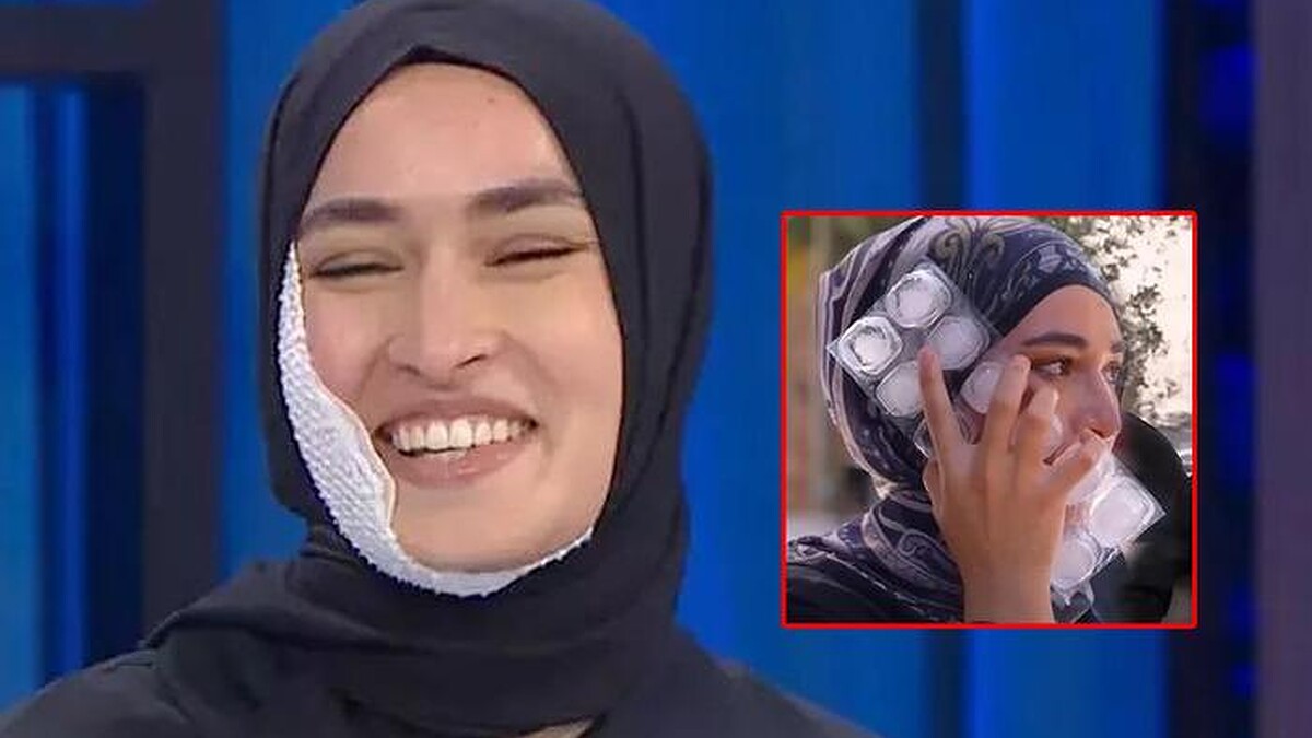 Beyza'nın Yüzündeki Yaraları Aniden Kayboldu, İzleyiciler Kazanın Kurgusal Olabileceğini Tartışıyor