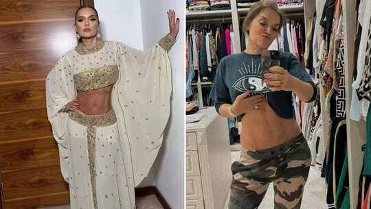 Demet Akalın kaslarını sergiledi: Zayıflama iğnesiyle 11 kilo verip zor dönem geçirdim