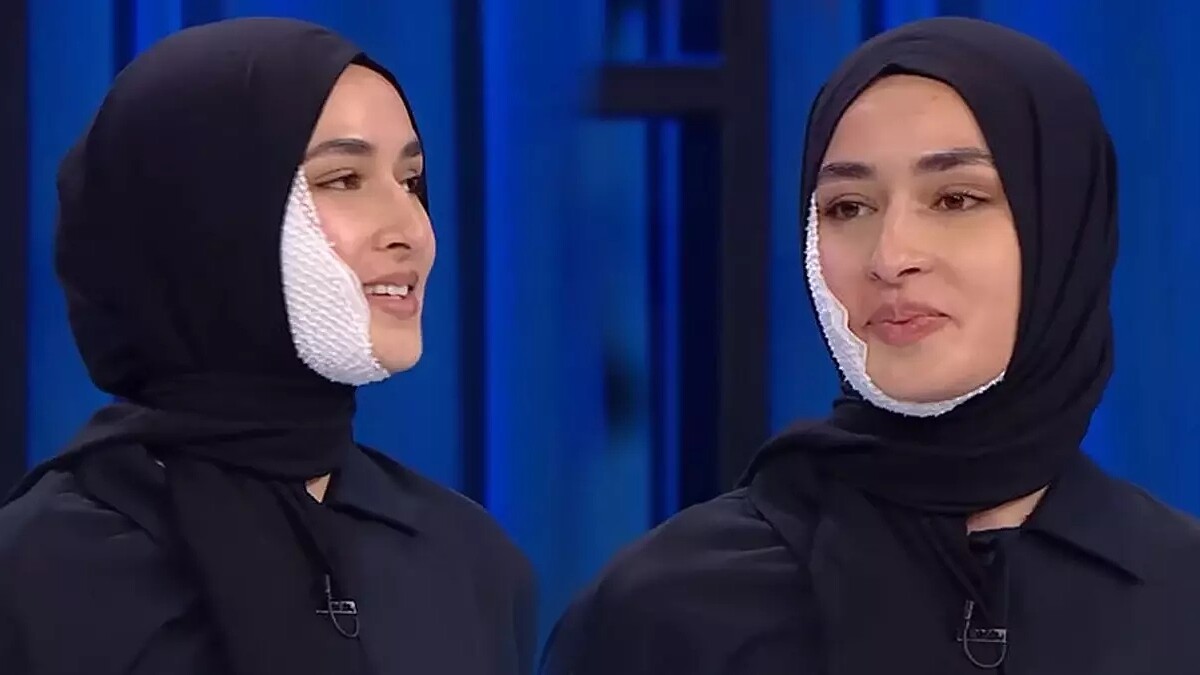 MasterChef Beyza'nın Yüz Yarası ve Hızlı İyileşmesi İzleyicileri Şaşırttı