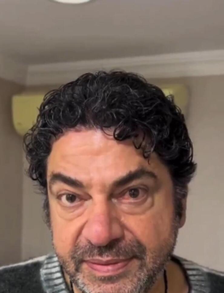 Hakan Taşıyan organ nakli sonrası botoks yaptırdı! Son hali şaşırttı...