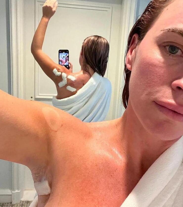 Teddi Mellencamp, cilt kanserini yendi ama beyninde tümör bulundu!
