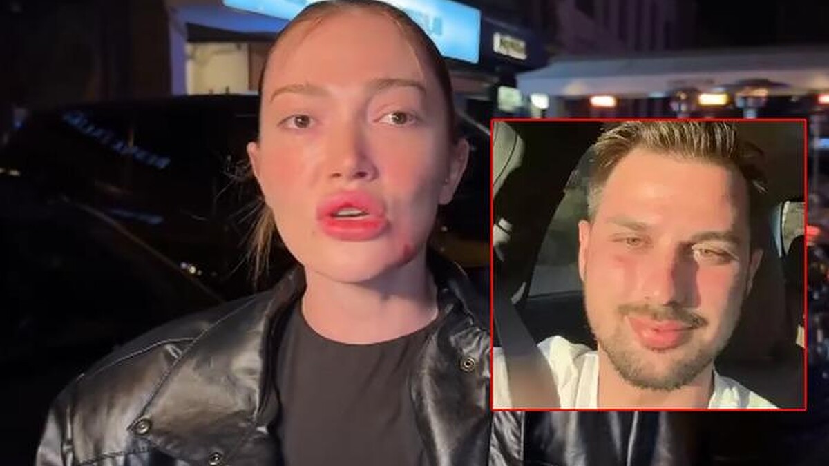 Danla Bilic, eski sevgilisi Berk Çetin tarafından darp edildikten sonra ilk kez görüntülendi! Yüzünün hali ve açıklaması dikkat çekti.